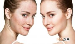 多吃蔬菜水果 皮肤干燥缺什么维生素，维生素A和维生素C