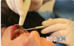 哪里洗牙好 桐乡哪里洗牙好