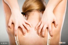 晚上睡觉皮肤痒,白天不痒 为什么一睡觉就痒