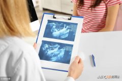 连续一个星期流褐色分泌物 有褐色分泌物是怎么回事