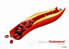 胸闷气短老想深呼吸 胸闷气短吃什么药