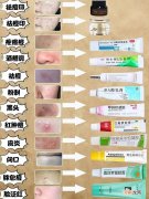去除痘印用什么药膏 痘痘如何处理