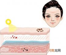 怎样养好皮肤 怎样养好皮肤屏障