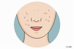 脸上天天长痘 为什么我脸上总是长痘痘