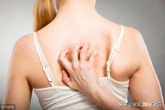 出太阳全身就痒 为什么太阳晒了全身痒