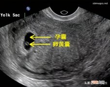 怀孕多久有胎心胎芽是正常的 胎心要多久