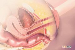 女性尿路感染怎么办 尿道在哪里