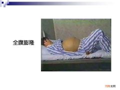 腹在哪里 右下腹在哪里