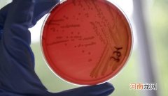 埃菲社：肠癌治疗后复发和转移元凶被科学家揪出 致病细胞作怪有办法遏制