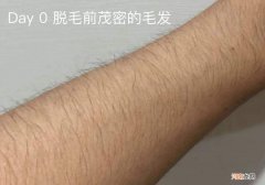 哪里有脱毛仪实体店 哪里有脱毛