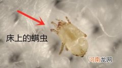 床上被子上的螨虫图片 显微镜下真实的螨虫是什么样子的图片