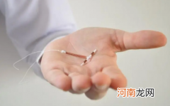 上环了多久可以恢复性生活