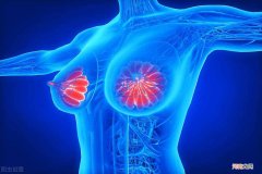 乳腺增生自己如何调理 乳腺增生怎么办