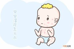 湿疹的4个误区 大人湿疹