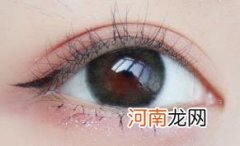 戴美瞳角膜受损还可以复原吗