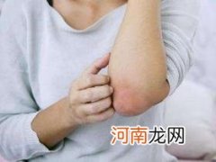 皮肤痒是身体哪里出问题了？警惕这几种病！