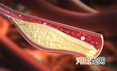 胆固醇愈低真的愈好吗