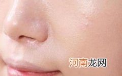 脸上浮粉怎么快速补救