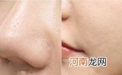 浮粉是因为油还是干