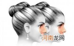 硅胶隆鼻是永久的吗