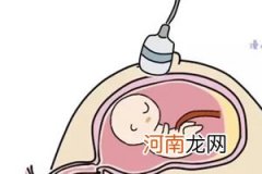 妇科b超多少钱一次 怎么检查的尴尬吗