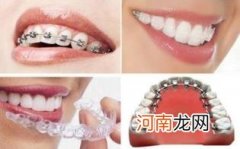 隐形牙套和钢丝牙套哪个效果好