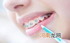 种牙和牙套哪个比较好
