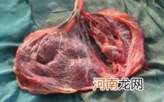 胎盘二级不能剖腹产吗