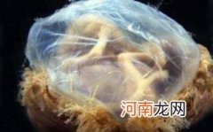 什么是胎盘前置?